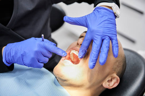 Best Cracked Tooth Emergency Dentist  in Ponchatou, LA